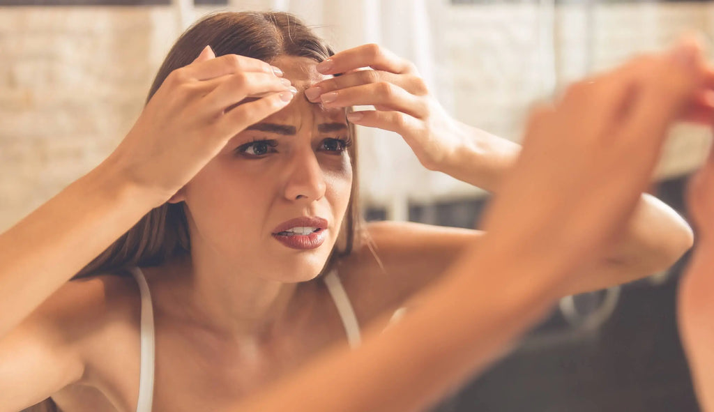 ¿Cuál es la causa de tu brote de acné?